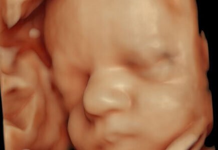 (4d) Obestetric and Fetal Anomaly scan- (Full, recorded, and Updated)C