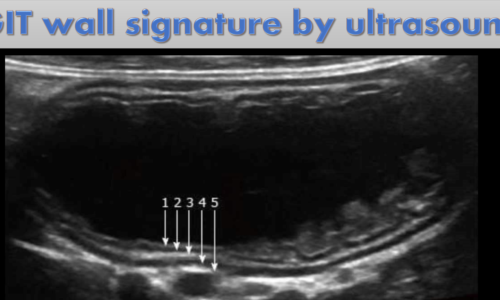 BOWEL ULTRASOUD & ADVANCED ABDOMINAL DOPPLER