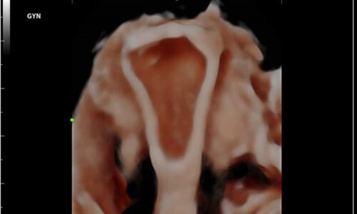 Gynecology Course – (2d) and (advanced 3d) Ultrasound