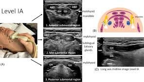 Advanced Neck Ultrasound